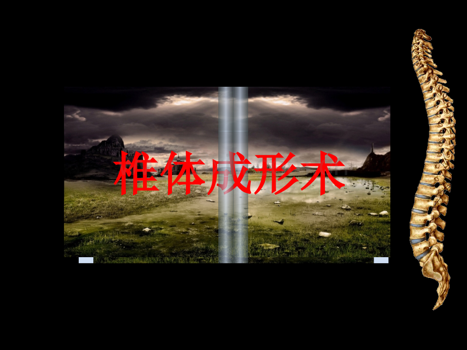 椎体成形术专业知识宣讲.pptx_第1页