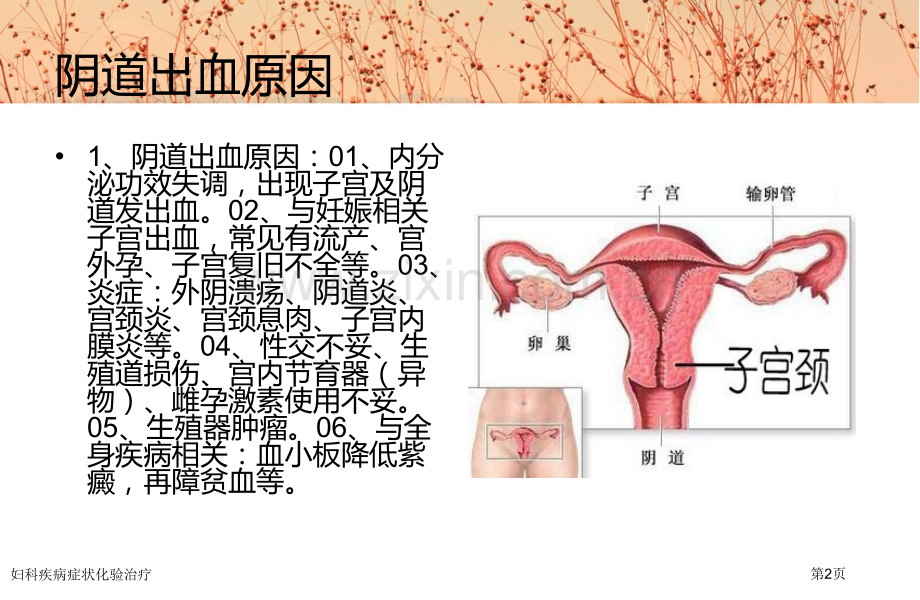 妇科疾病症状化验治疗专家讲座.pptx_第2页