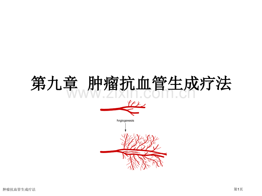 肿瘤抗血管生成疗法专家讲座.pptx_第1页