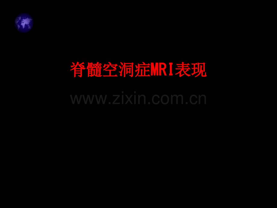 脊髓空洞症MRI表现-.pptx_第1页