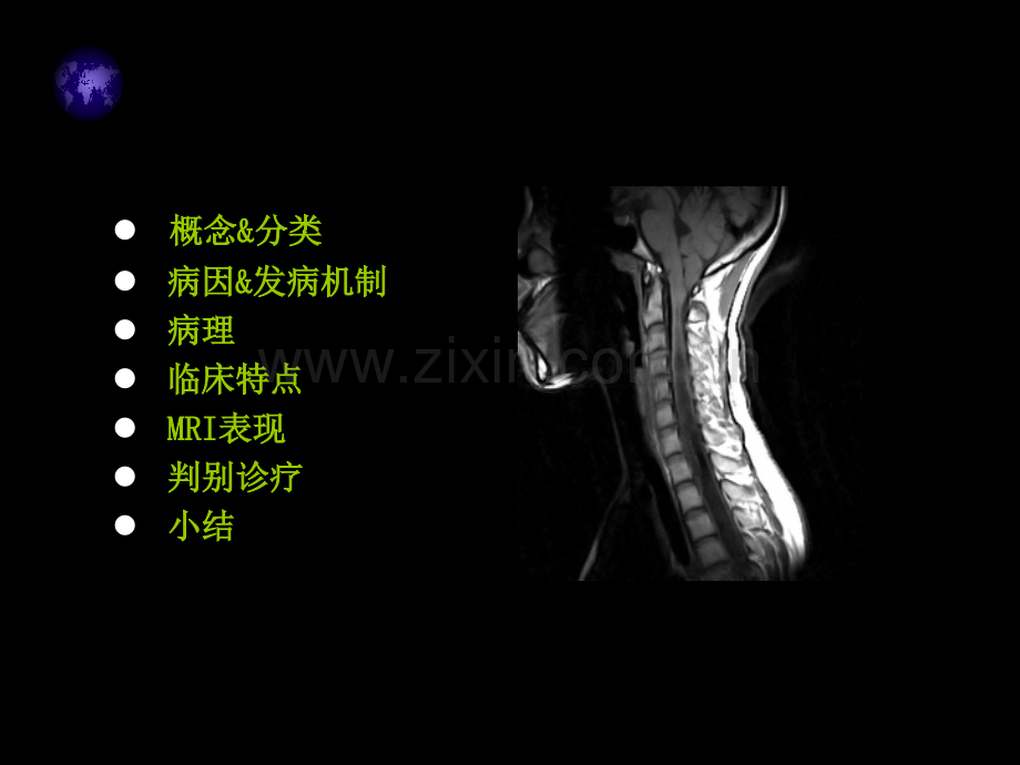 脊髓空洞症MRI表现-.pptx_第2页
