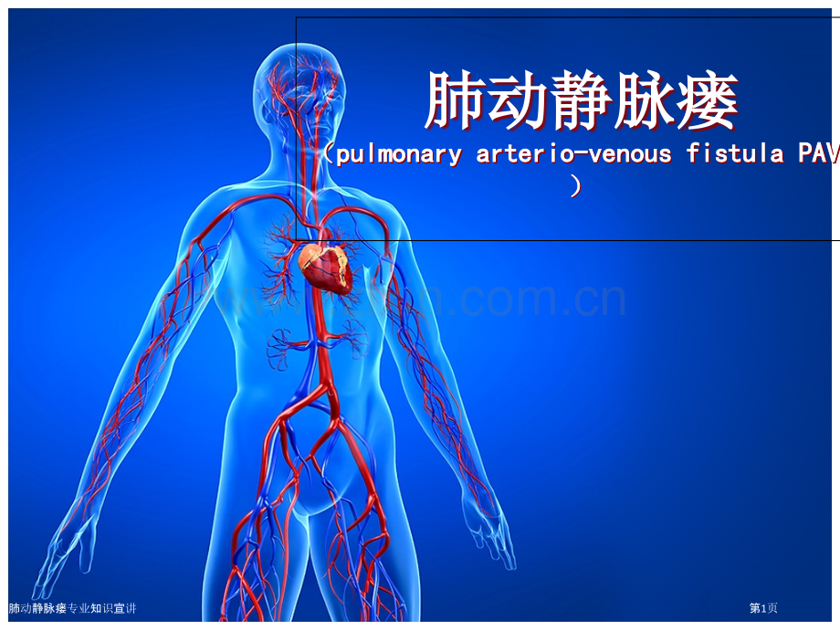 肺动静脉瘘专业知识宣讲.pptx_第1页