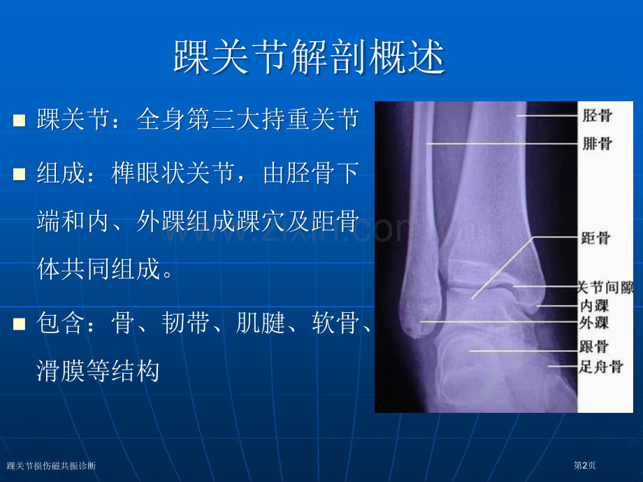 踝关节损伤磁共振诊断.pptx_第2页