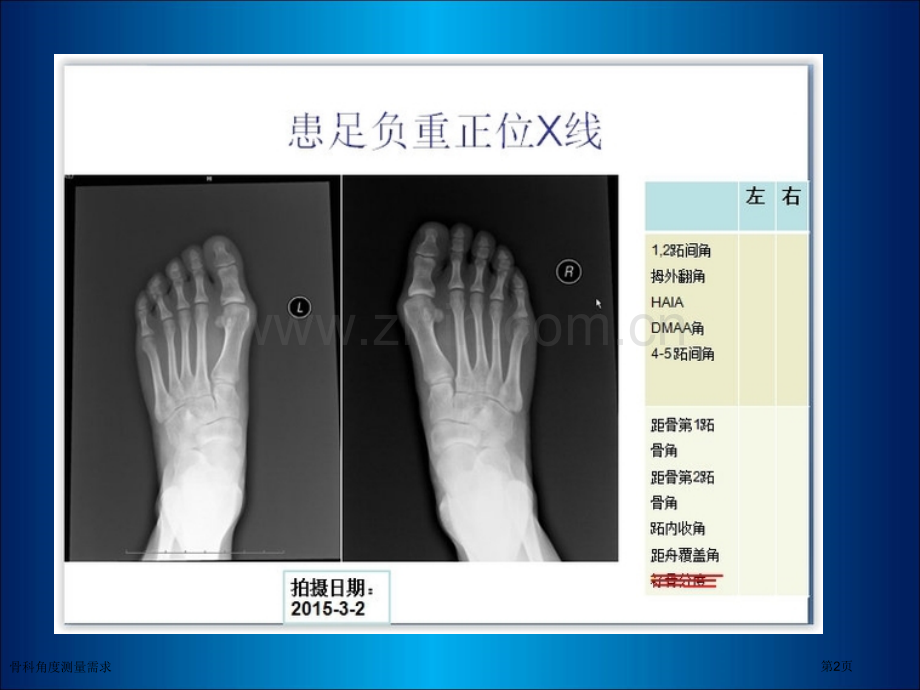 骨科角度测量需求.pptx_第2页