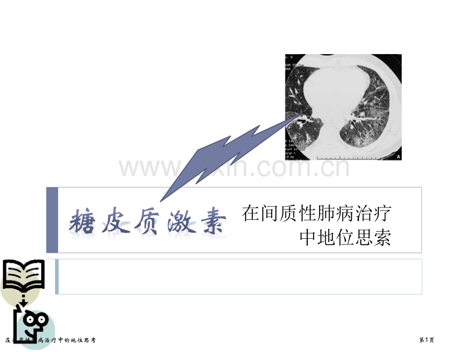 在间质性肺病治疗中的地位思考专家讲座.pptx_第1页