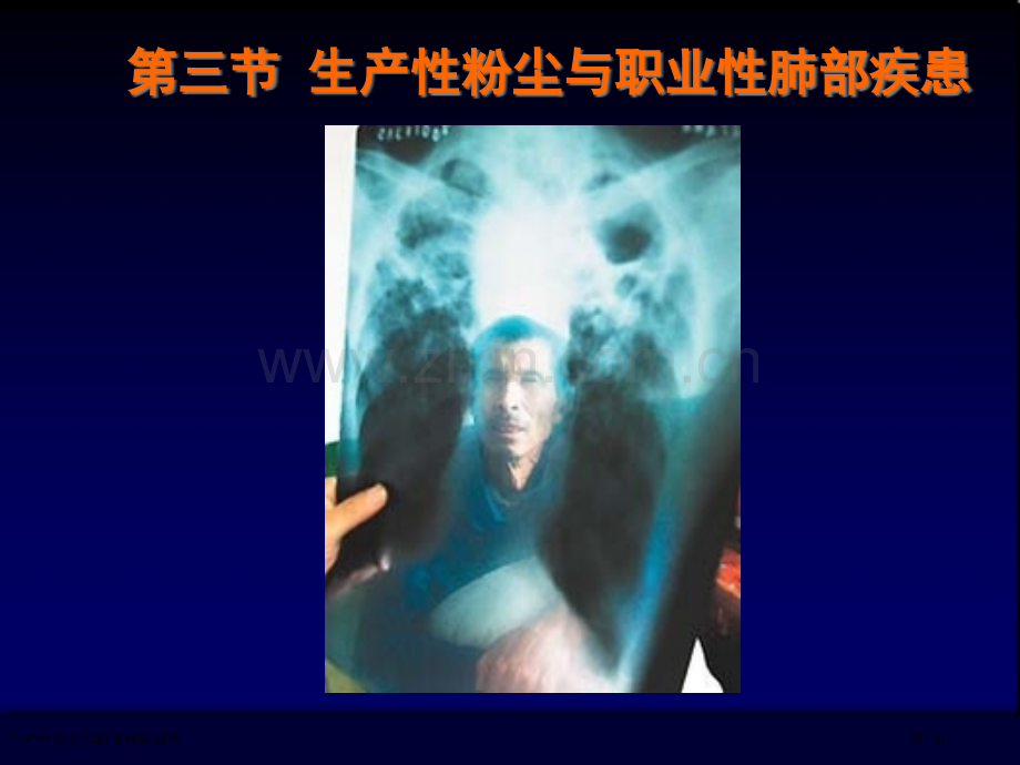 生产性粉尘和职业性肺部病专家讲座.pptx_第1页