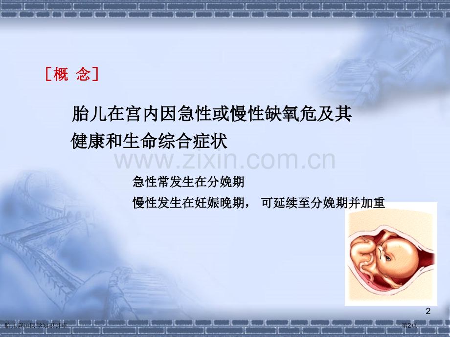 胎儿窘迫医学知识讲座专家讲座.pptx_第2页
