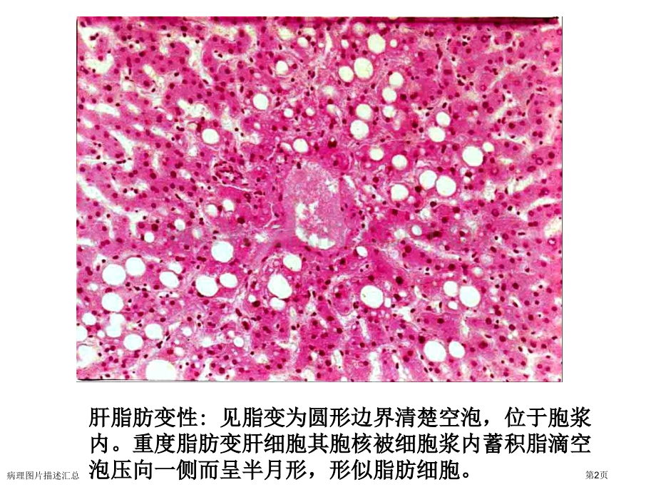 病理图片描述汇总.pptx_第2页
