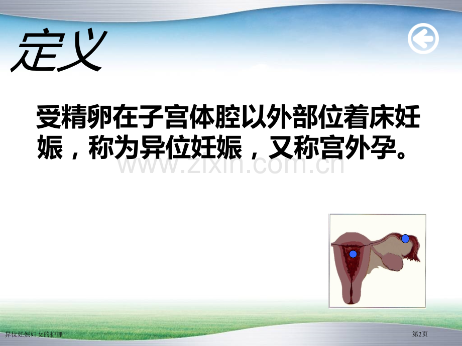 异位妊娠妇女的护理专家讲座.pptx_第2页