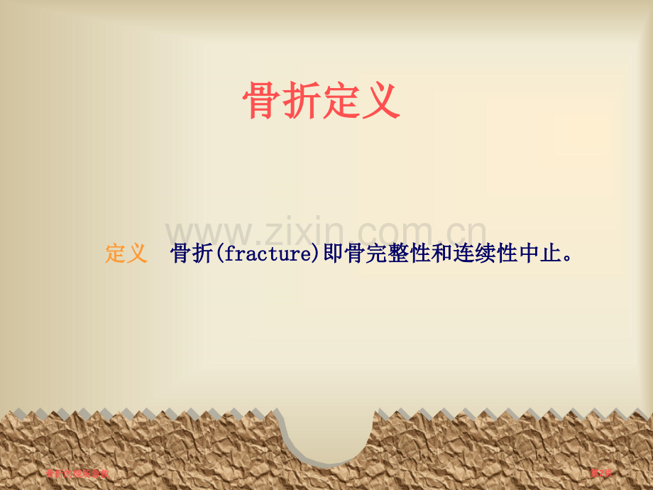 骨折的现场急救.pptx_第2页