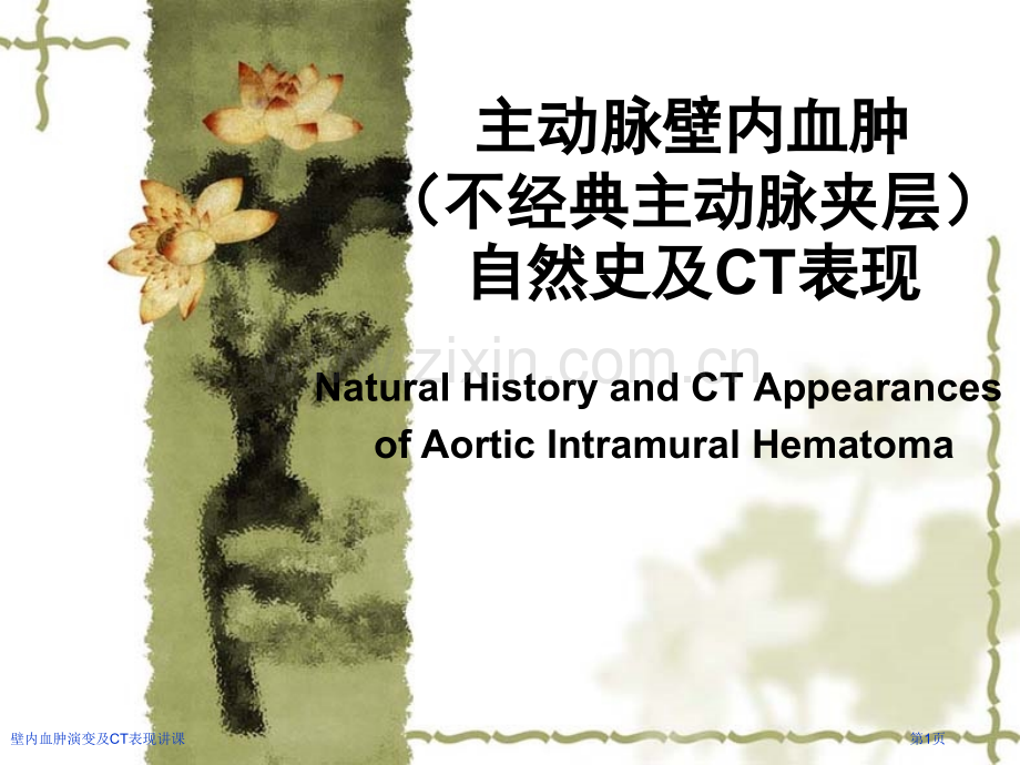 壁内血肿演变及CT表现讲课.pptx_第1页