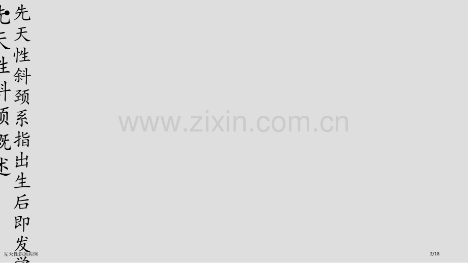 先天性斜颈病例.pptx_第2页