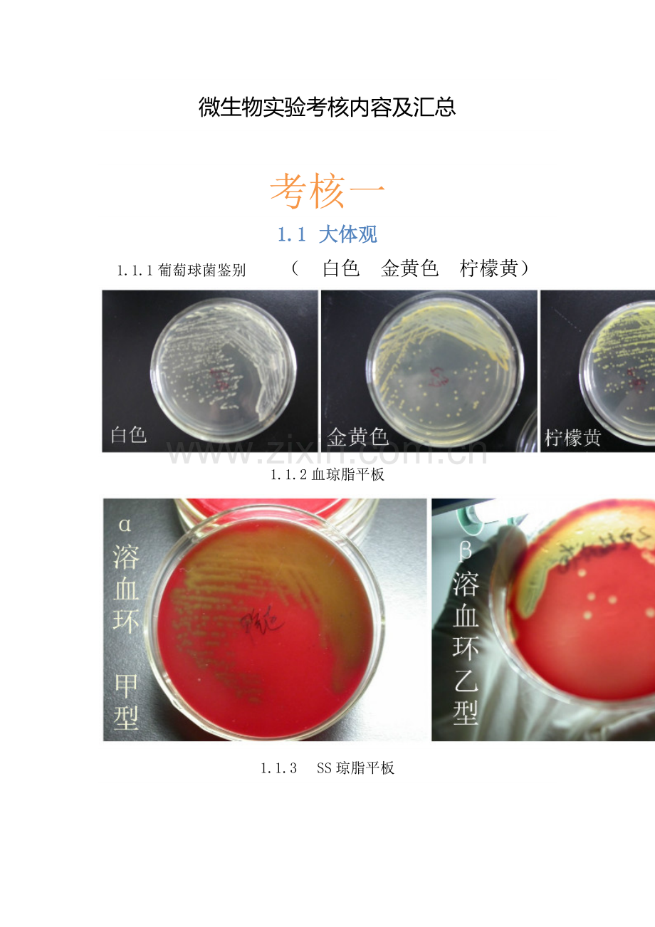 微生物实验考核内容及汇总.doc_第1页