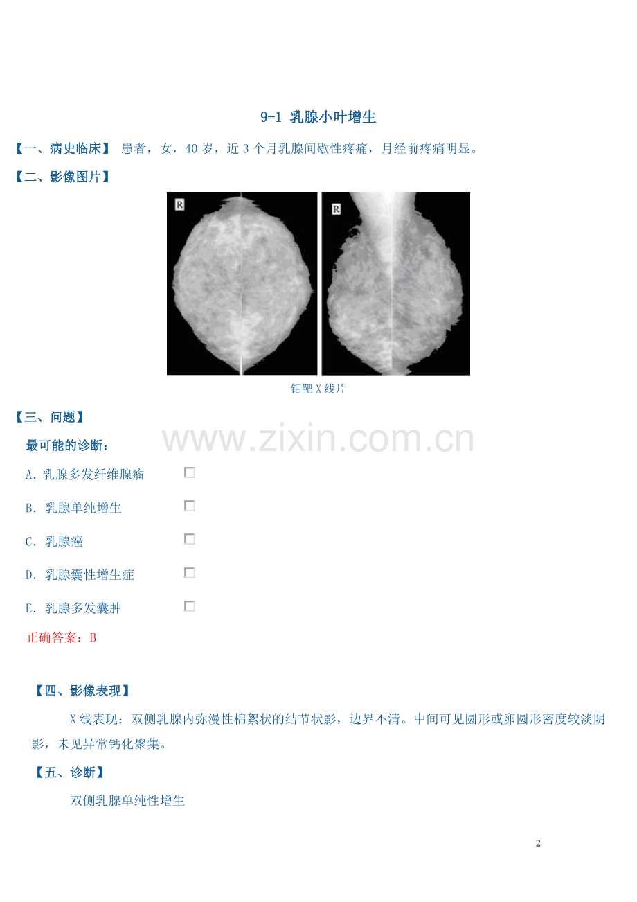 乳腺病例讨论.doc_第2页