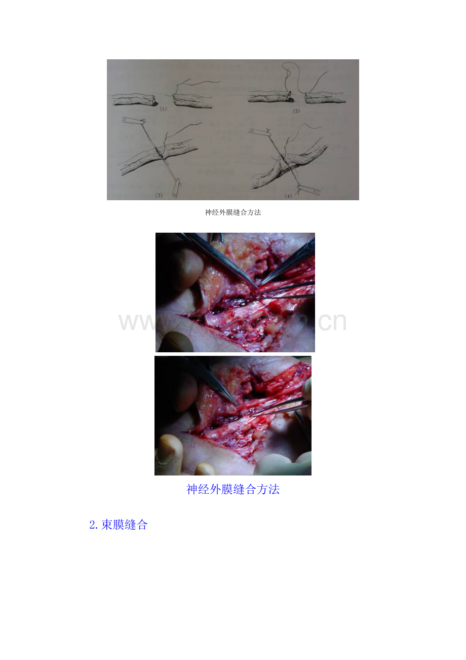 神经组织的修复.doc_第2页