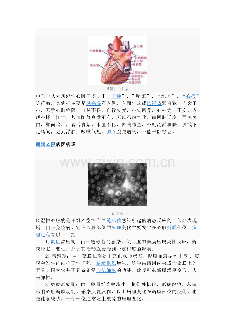 风湿性心脏病.doc_第2页