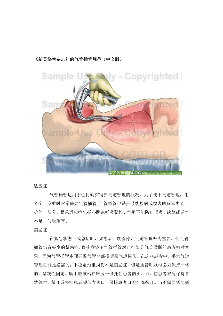 新英格兰杂志的气管插管规范(中文版).doc_第1页
