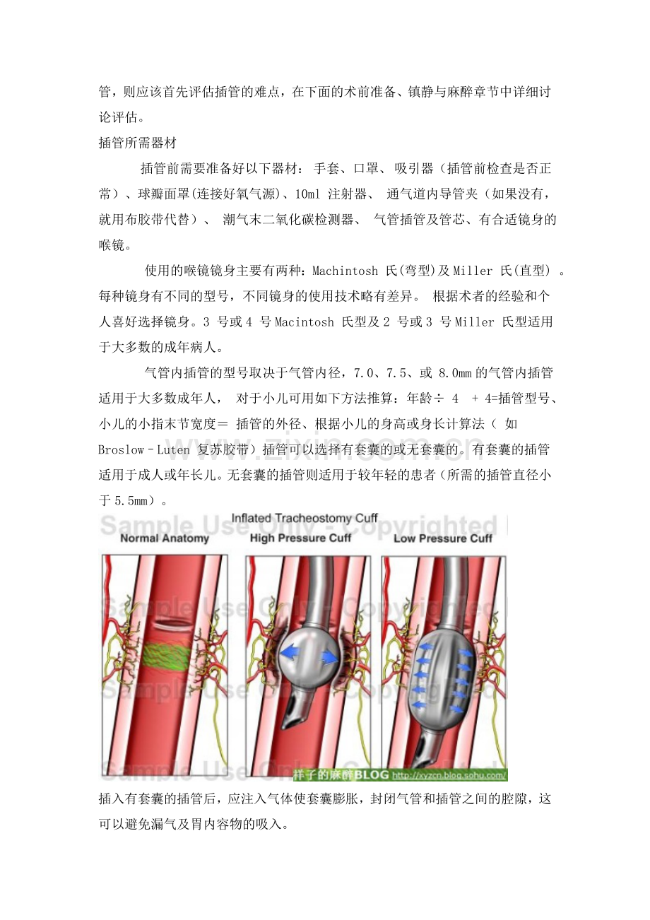 新英格兰杂志的气管插管规范(中文版).doc_第2页