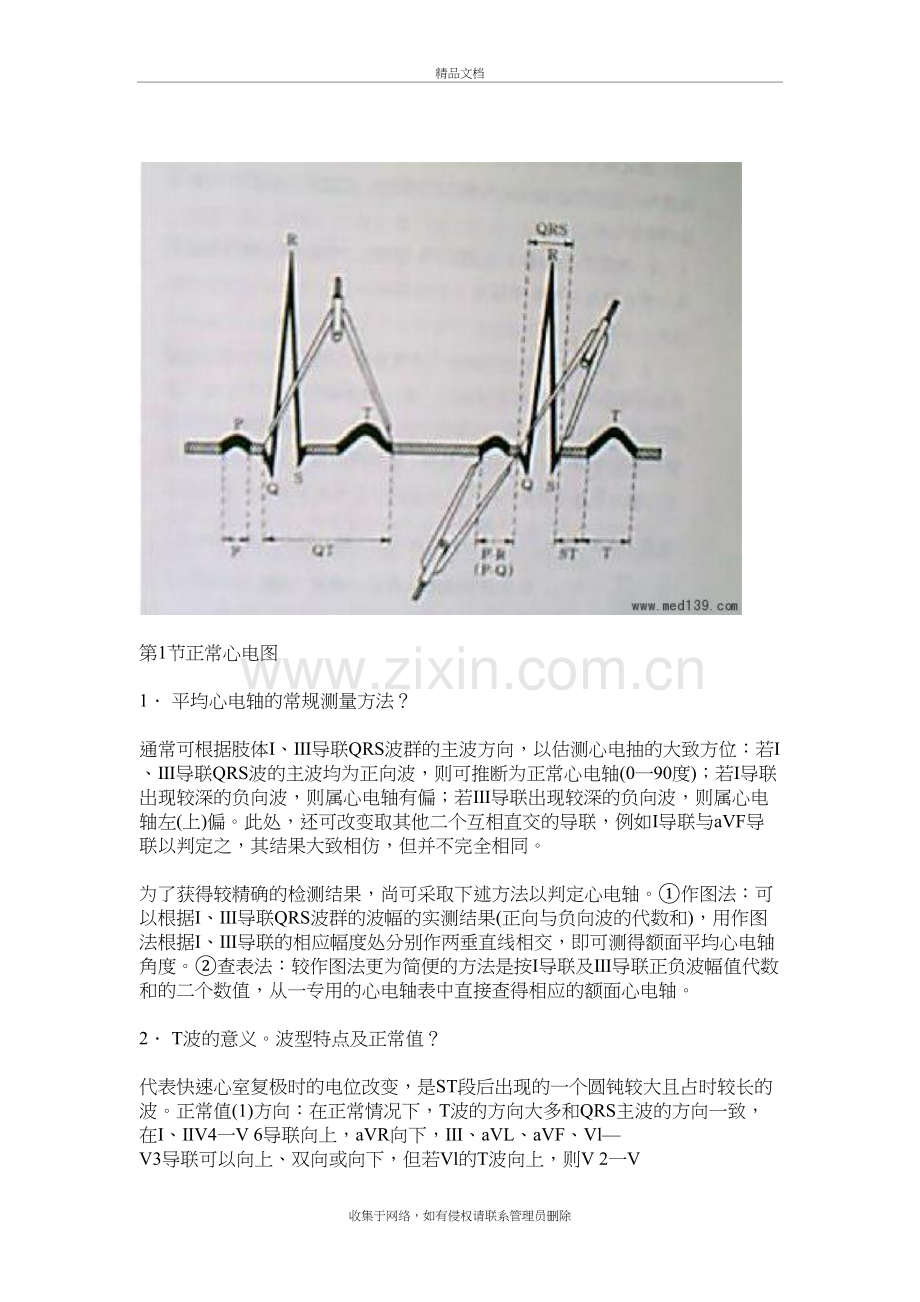 临床执业医师资格考试心电图复习要点教案资料.doc_第2页