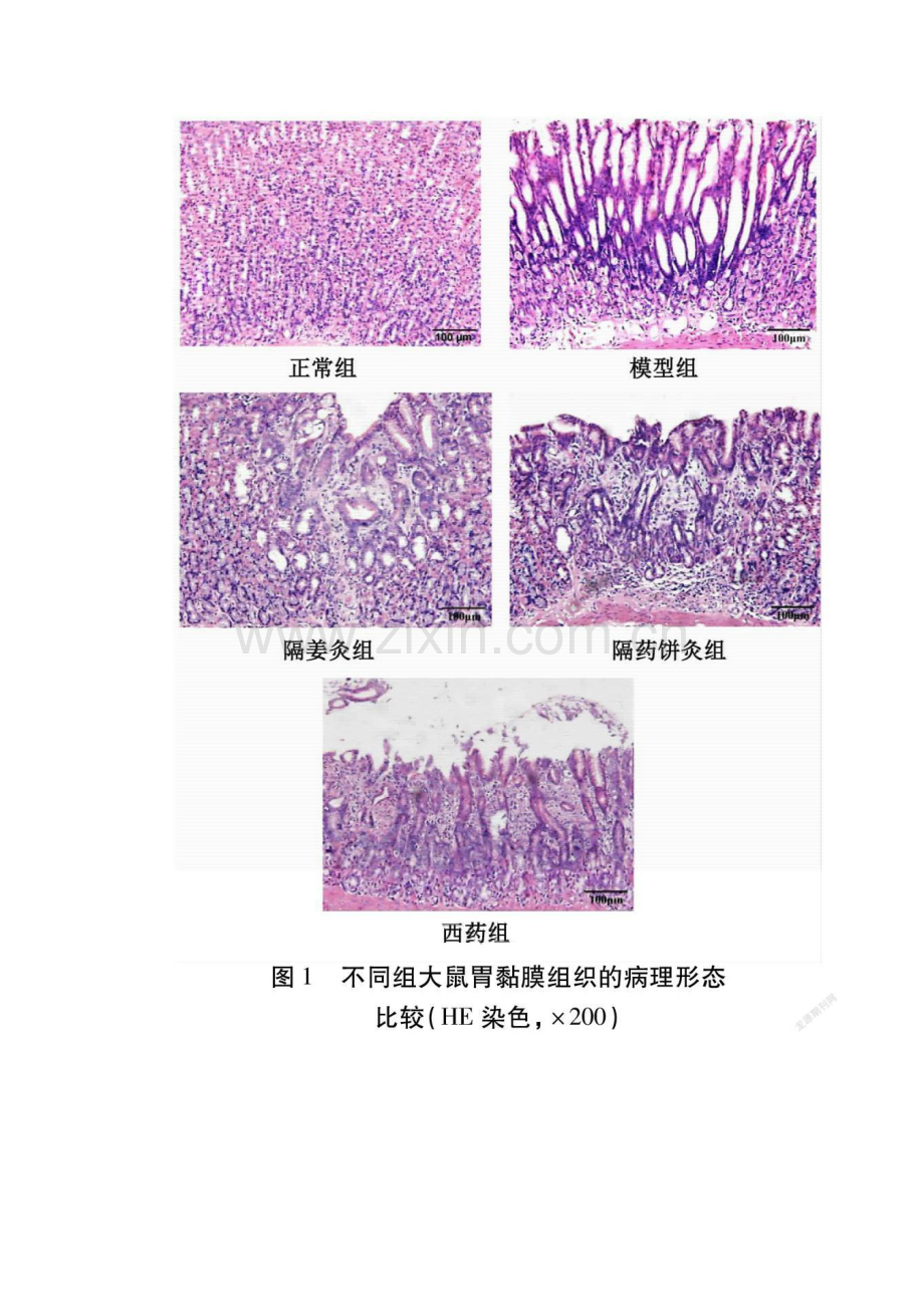 隔物灸调控缺氧诱导因子-1α表达抑制慢性萎缩性胃炎大鼠糖酵解的机制研究.docx_第2页