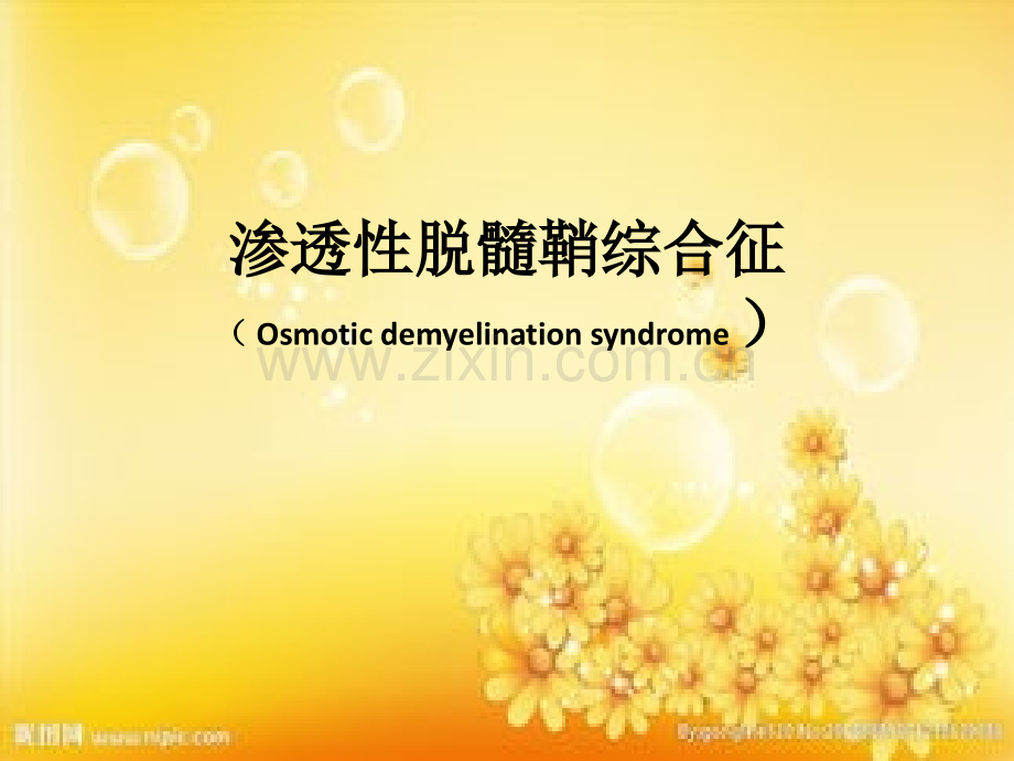 渗透性脱髓鞘综合征PPT.ppt_第1页