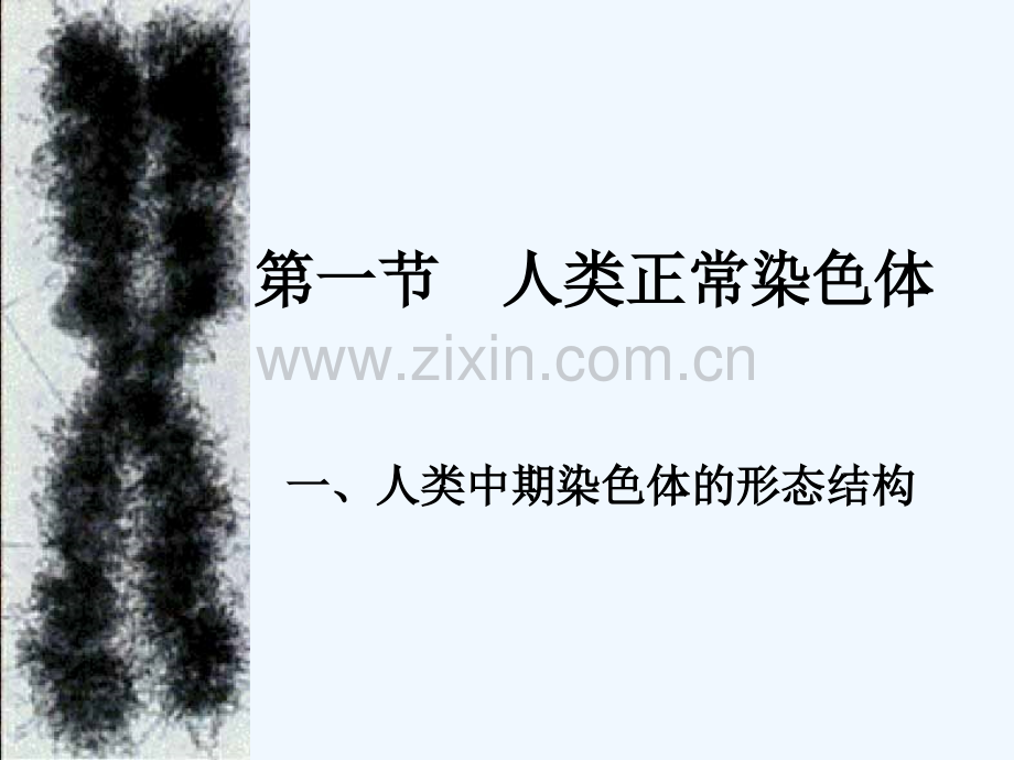 人类染色体疾病的诊断.ppt_第1页