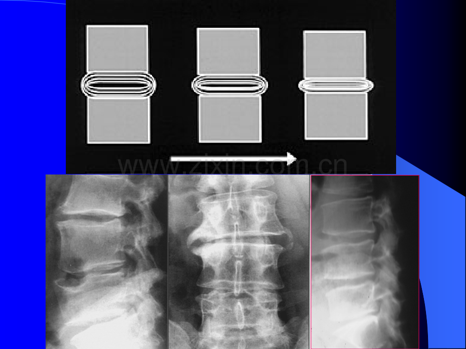 骨关节系统影像诊断(下).ppt_第2页