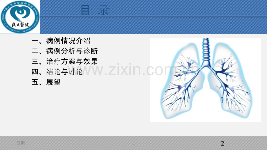 呼吸内科咯血-病例分享PPT课件.ppt_第2页