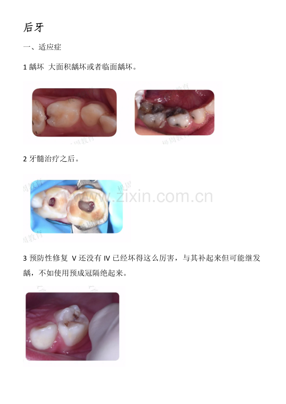 一步一步做好乳牙预成冠预成冠.doc_第2页