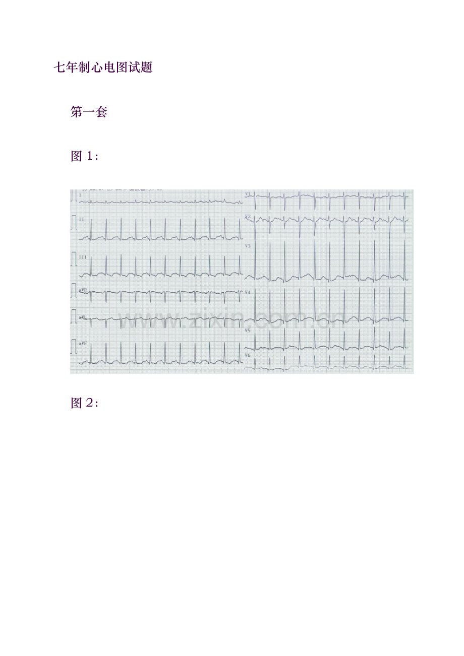 心电图试题及标准答案.doc_第1页