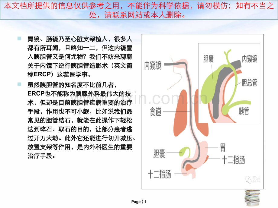原来有种造影叫ERCP培训课件.ppt_第1页