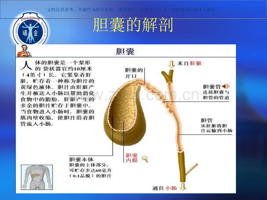 急性胆囊炎知识讲座课件.ppt_第2页