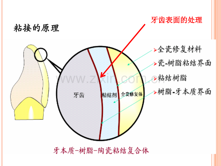 粘接剂的使用01.ppt_第2页