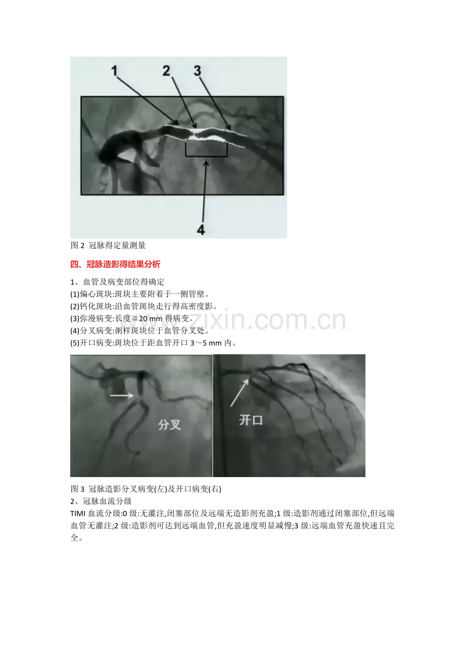 冠脉造影阅片总结.doc_第2页