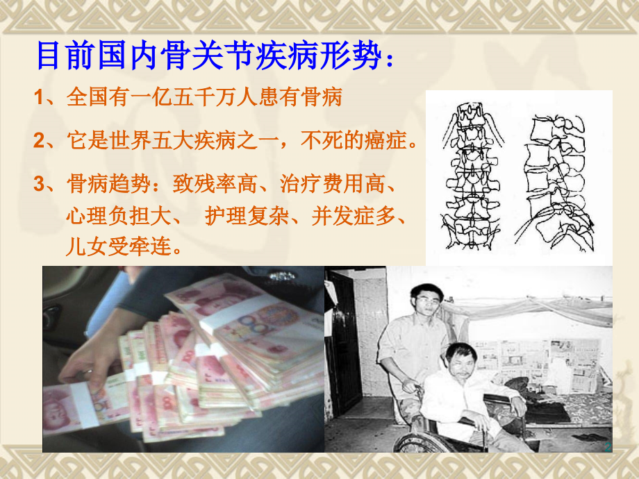 骨关节疾病防治专题讲座.ppt_第2页