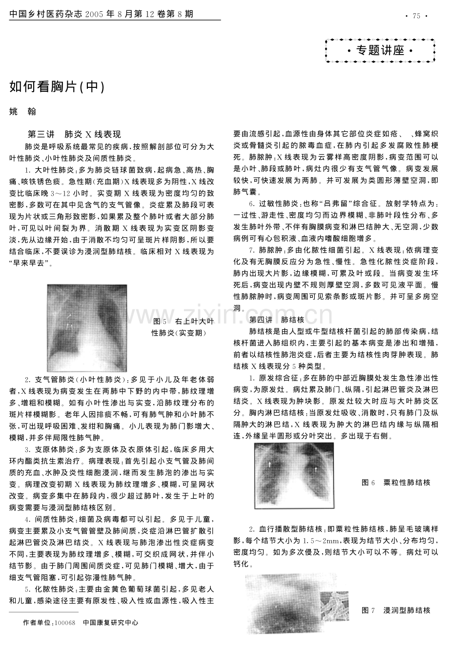 如何看胸片中.pdf_第1页