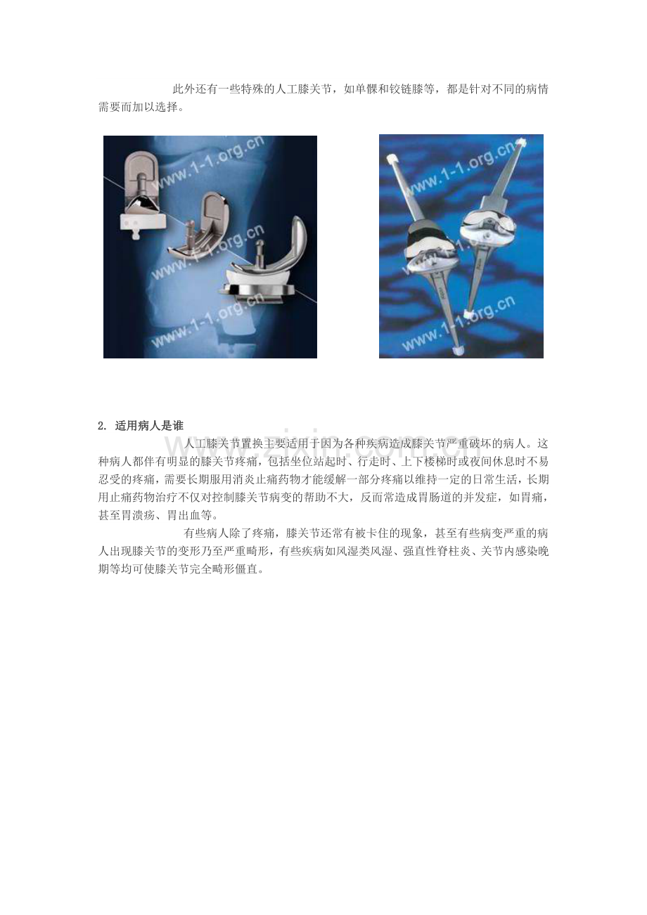 人工膝关节置换术后康复指南.doc_第2页