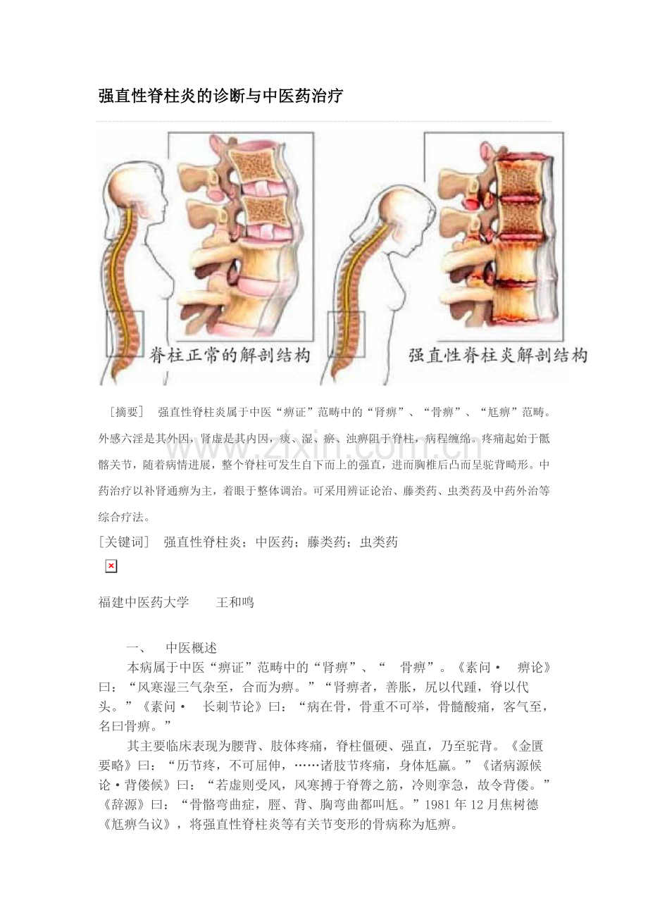 强直性脊柱炎的诊断与中医药治疗方法.doc_第1页
