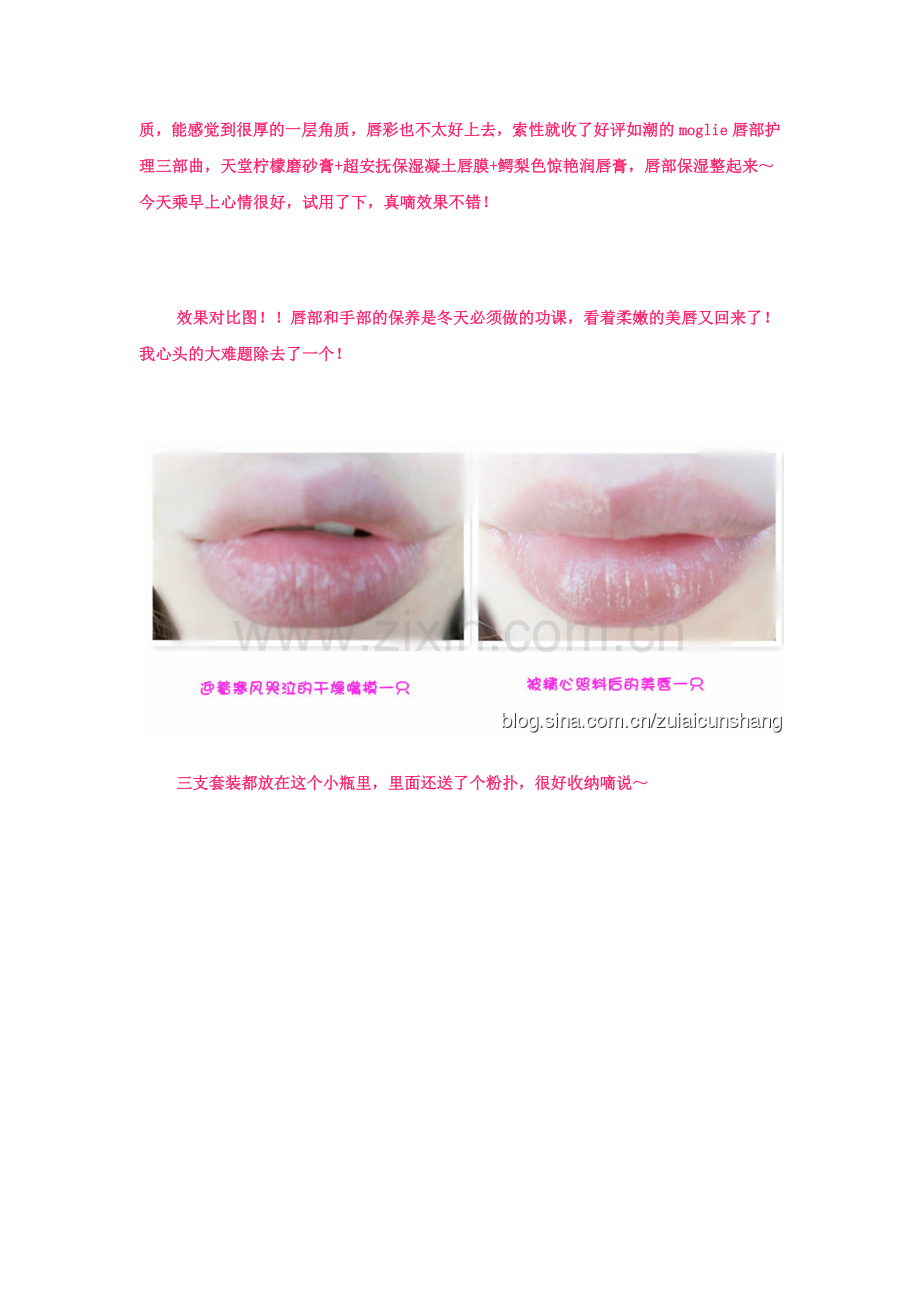 嘴唇干燥怎么办 求保湿滋润防干裂 唇部保养.docx_第2页