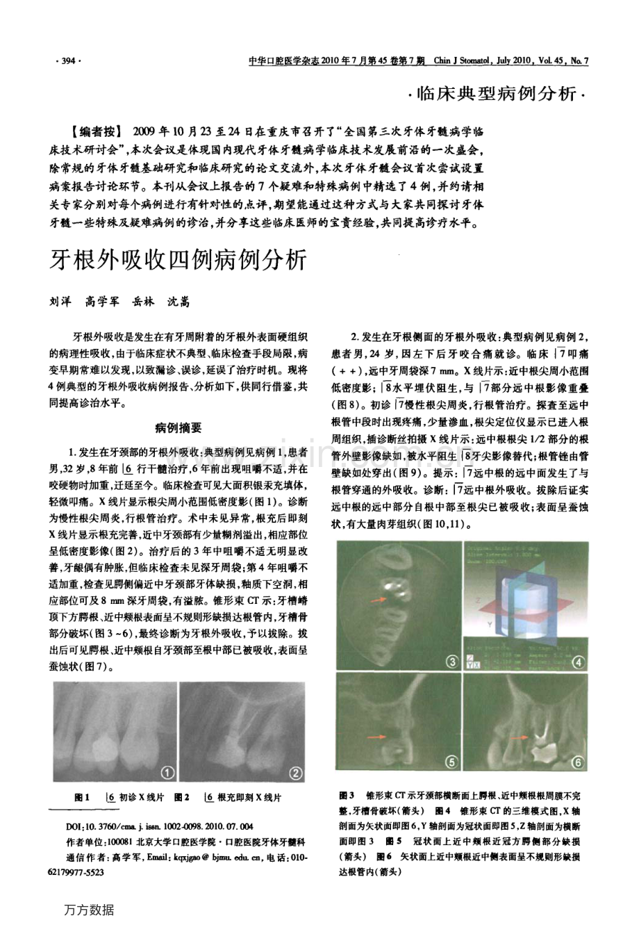 牙根外吸收四例病例分析.pdf_第1页