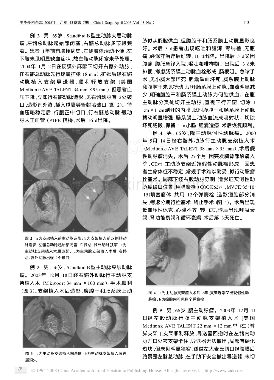 主动脉支架植入术后少见并发症及其治疗.pdf_第2页