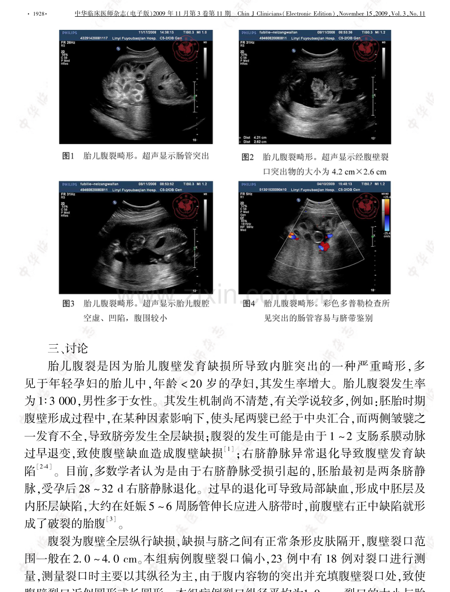胎儿腹裂的超声诊断.pdf_第2页