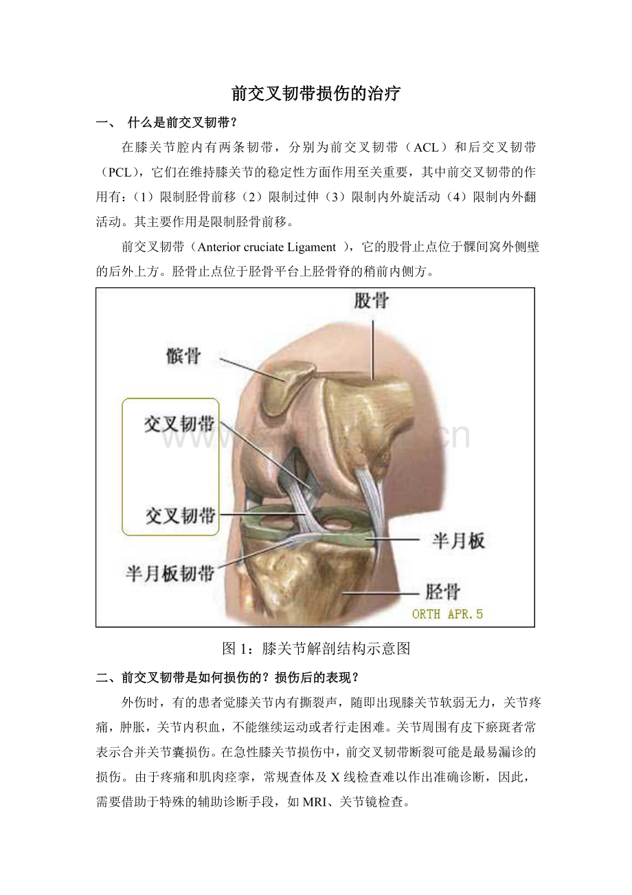 前交叉韧带损伤患者须知.doc_第1页