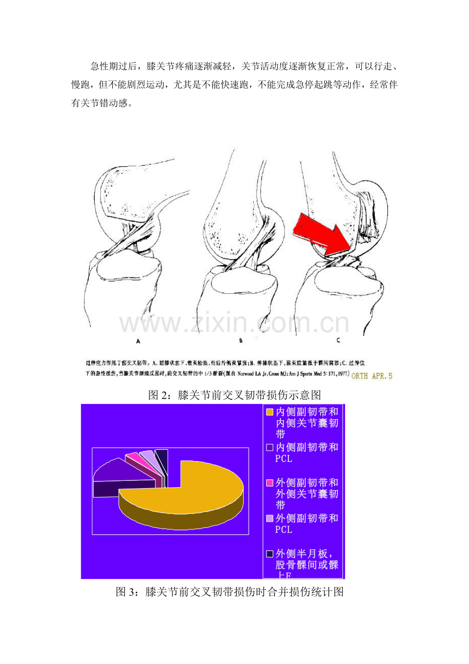 前交叉韧带损伤患者须知.doc_第2页