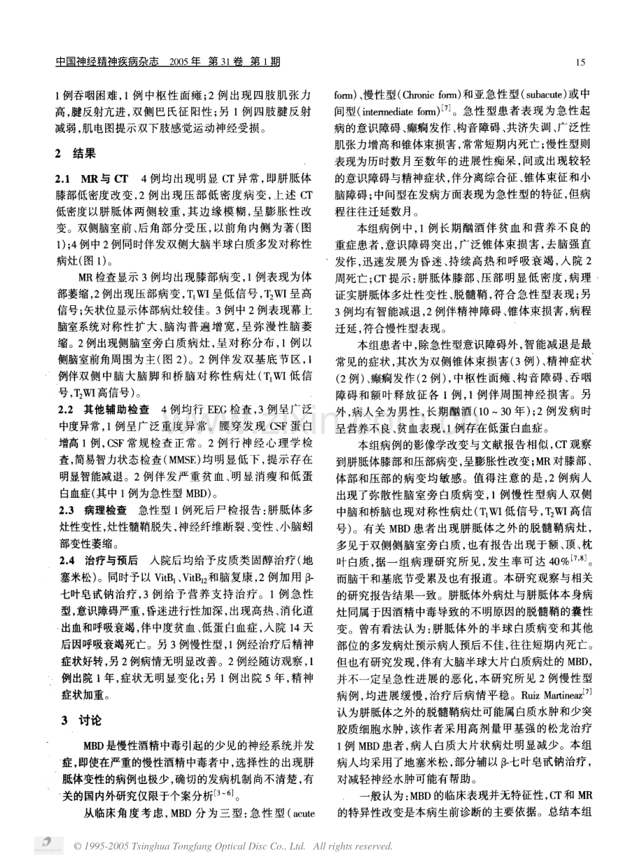 胼胝体变性.pdf_第2页