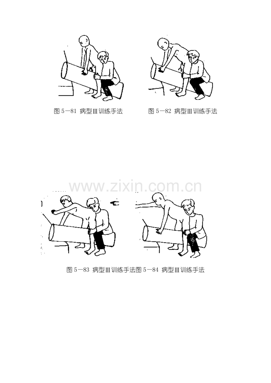 痉挛性双重性瘫痪或轻度痉挛性四肢瘫的脑瘫康复训练方.doc_第2页