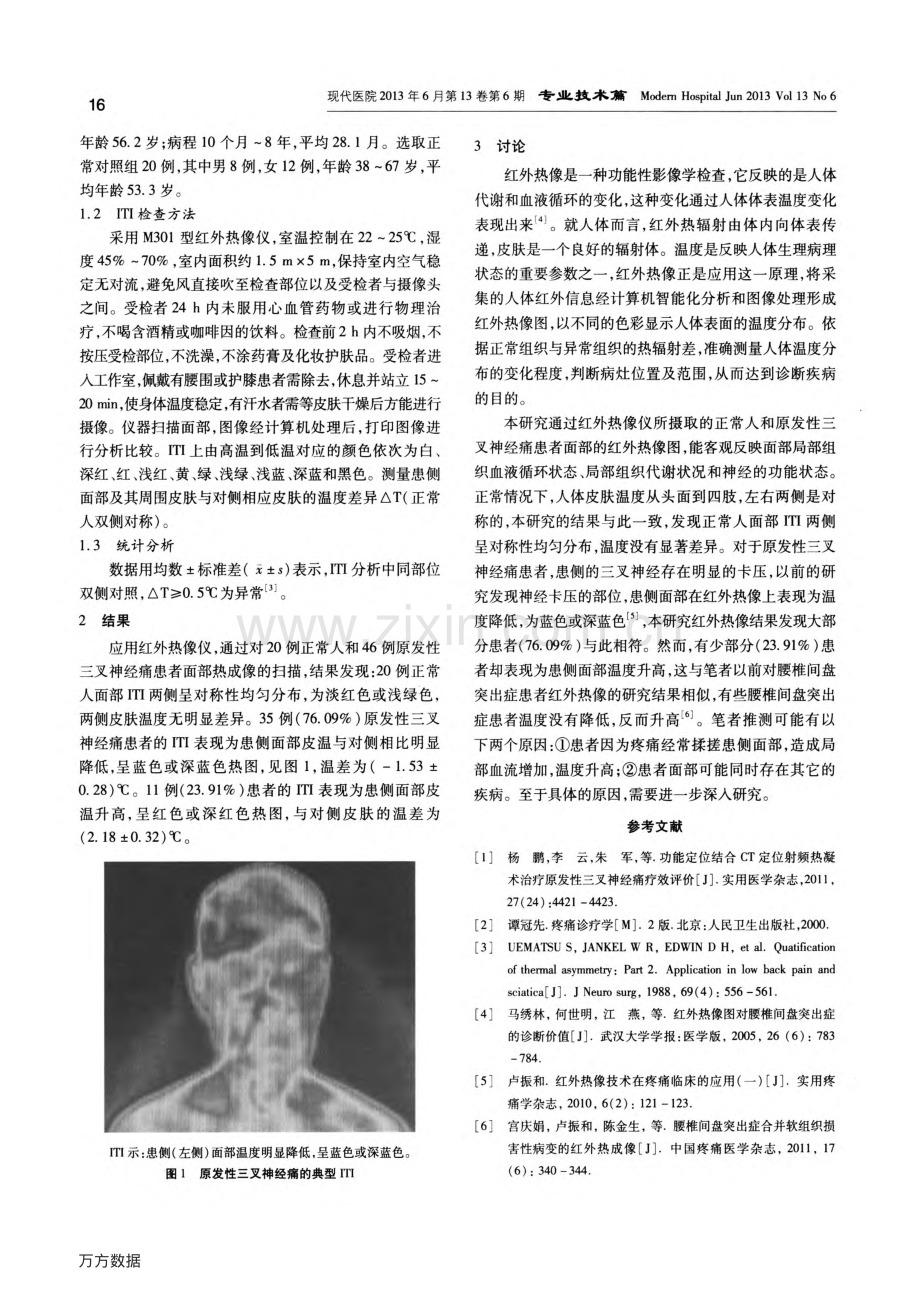 红外热像在原发性三叉神经痛诊断中的价值.pdf_第2页