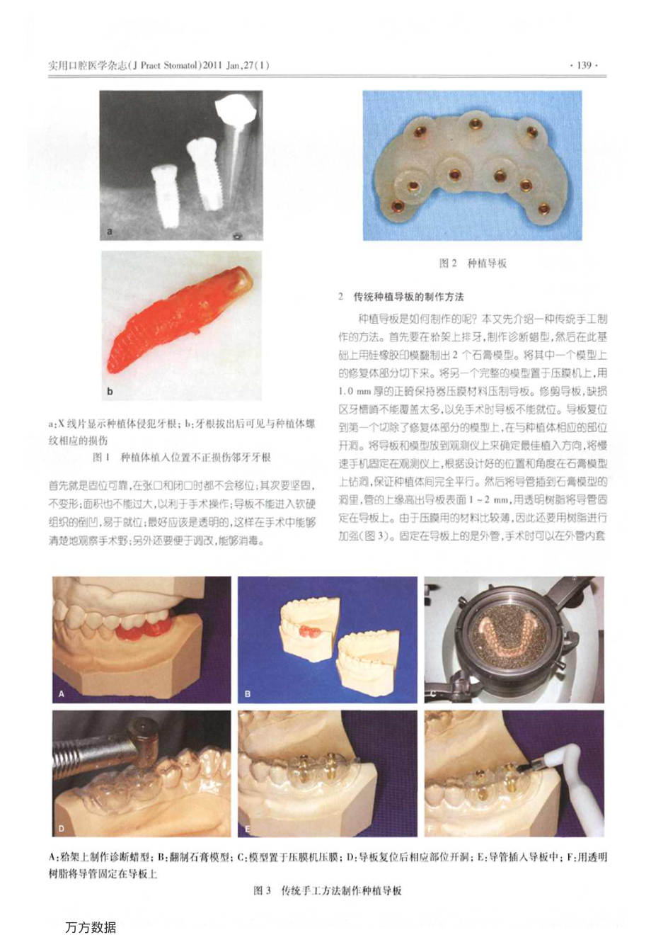 种植导板的制作及CADCAM技术的应用.pdf_第2页