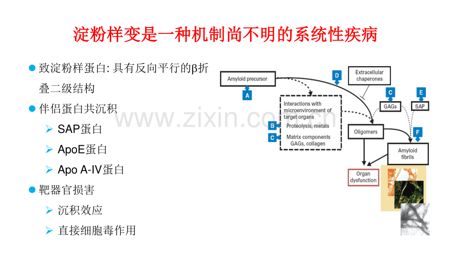 六淀粉样变的诊断和分型进展李剑.pdf_第2页