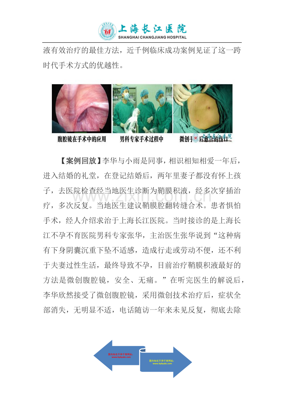 微创腹腔镜治疗鞘膜积液全面破解复发难题.docx_第2页